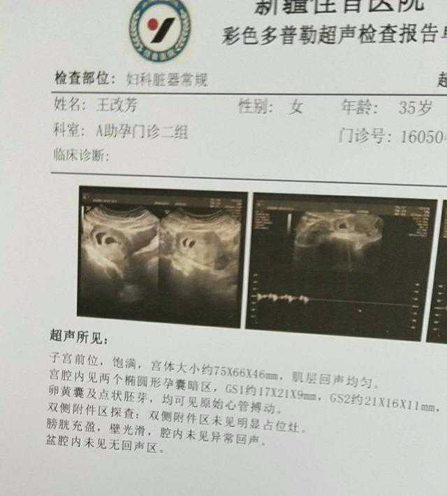 香港验血怀孕的单子图片,泰国试管婴儿成功受孕后孕早期准妈妈有哪些需要特